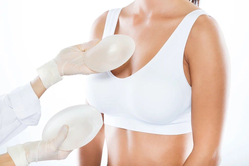 Auswahl der Implantate vor einer Brustvergrößerungsoperation