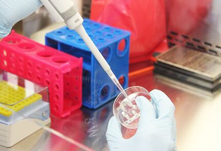 Überprüfung der Tests der Patientin vor der Durchführung einer Brustvergrößerung